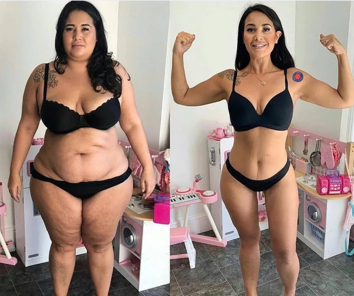 Before and after result 1