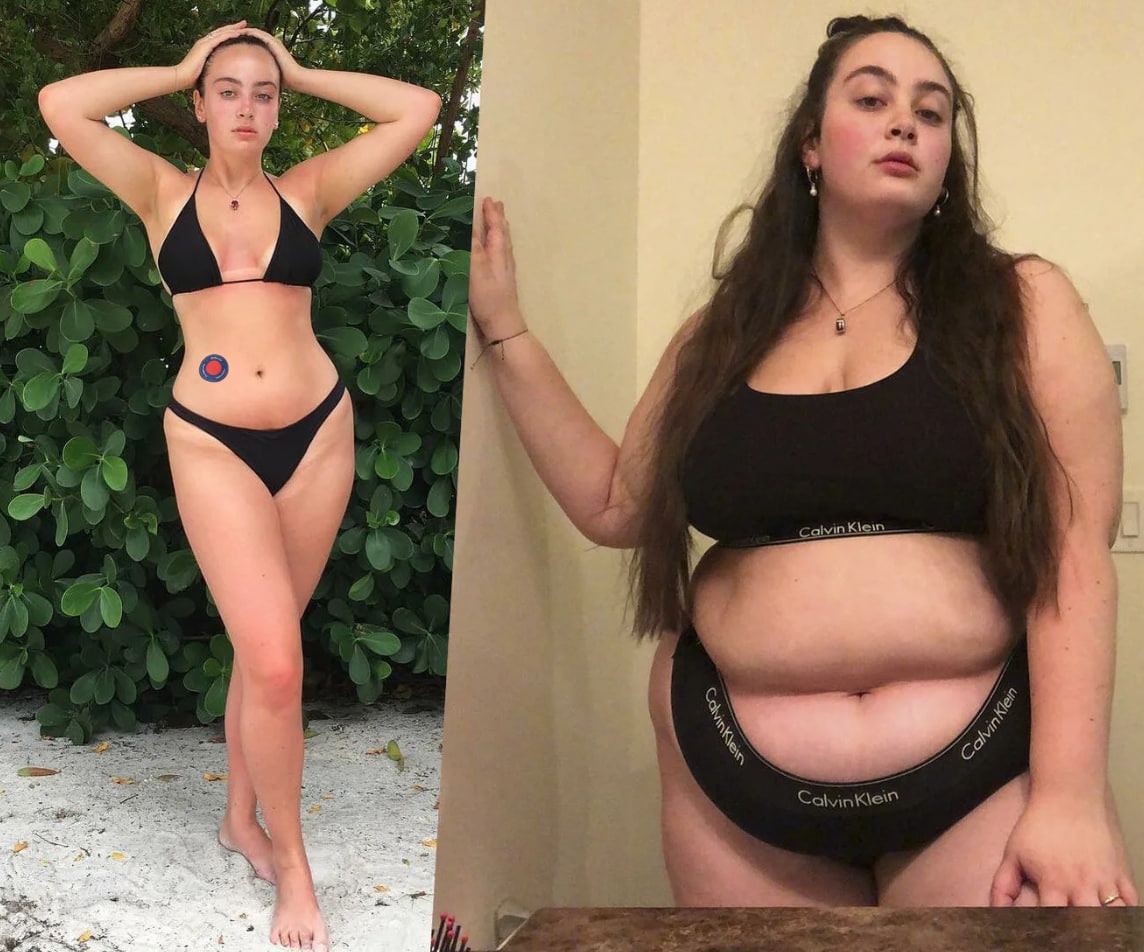 Before and after result 3